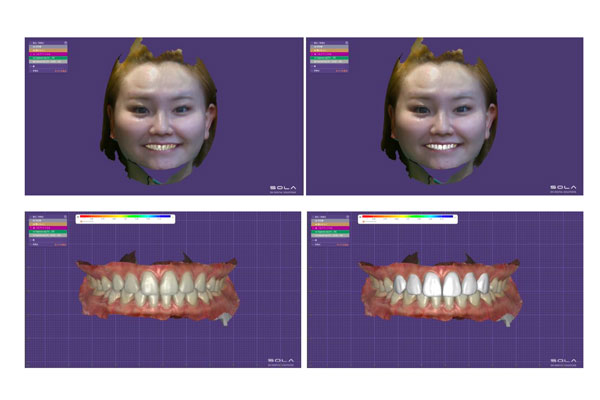 フェイススキャン